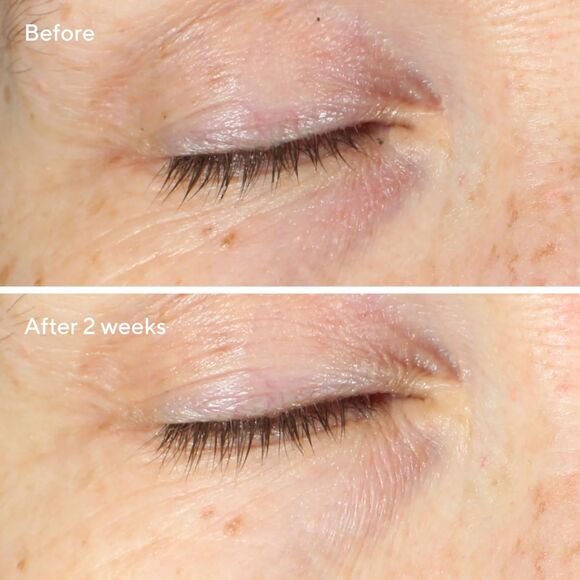 Murad - Vita-C Eyes - Dark Circle Corrector - Brand New! - Picture 3 of 5